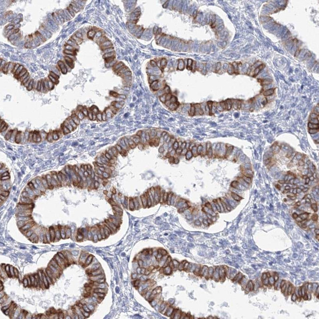 LRRIQ4 Antibody in Immunohistochemistry (Paraffin) (IHC (P))