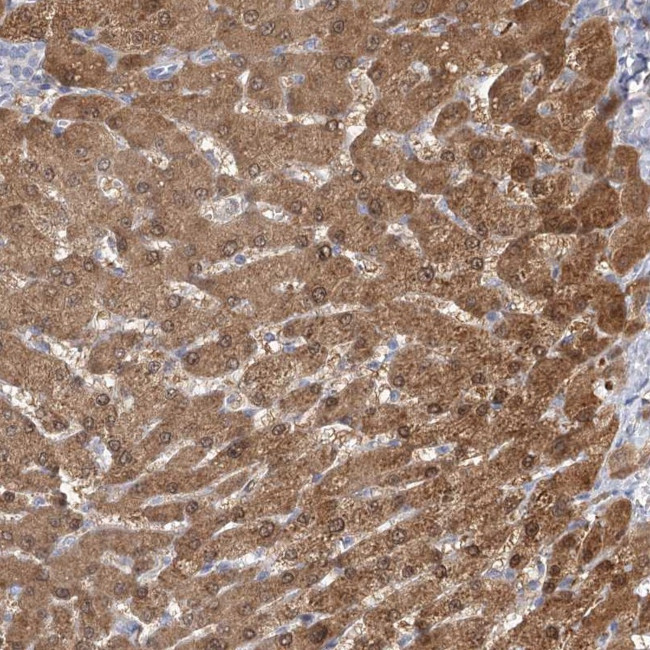 CNTLN Antibody in Immunohistochemistry (Paraffin) (IHC (P))