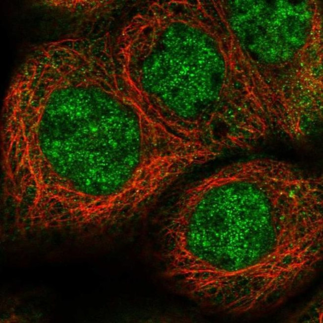 EPC2 Antibody in Immunocytochemistry (ICC/IF)