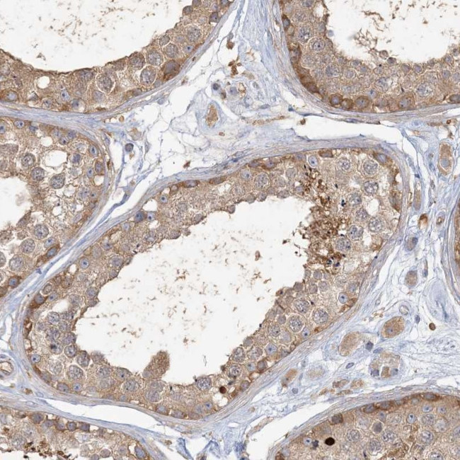 ANKS1 Antibody in Immunohistochemistry (Paraffin) (IHC (P))