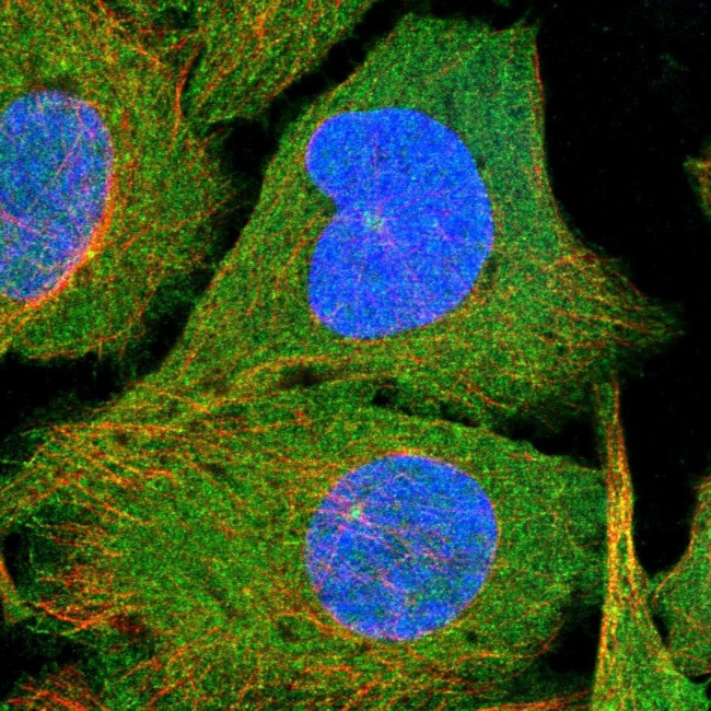 N4BP2 Antibody in Immunocytochemistry (ICC/IF)
