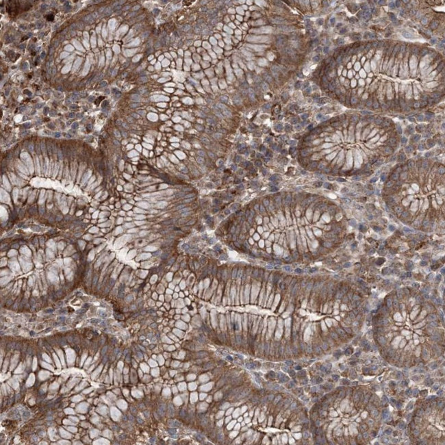 TTC7A Antibody in Immunohistochemistry (Paraffin) (IHC (P))