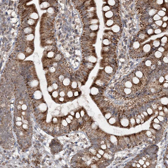 TTC7A Antibody in Immunohistochemistry (Paraffin) (IHC (P))