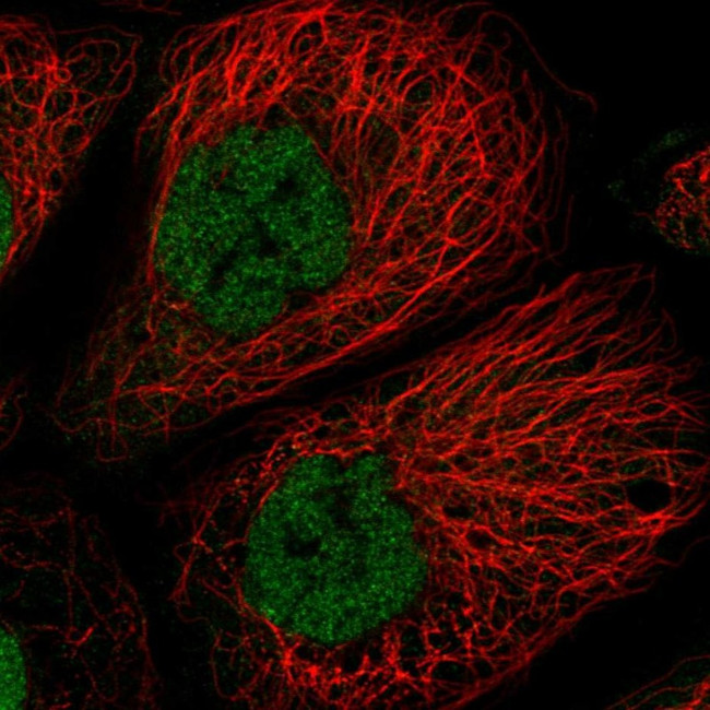 TCF20 Antibody in Immunocytochemistry (ICC/IF)