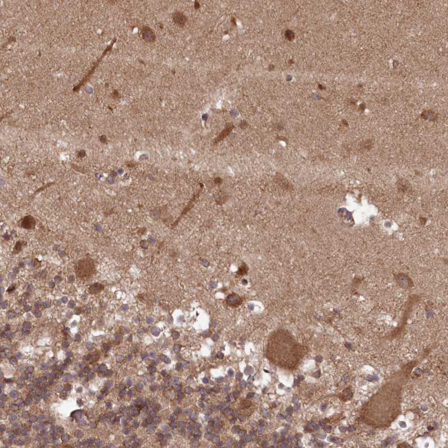 PPP1R21 Antibody in Immunohistochemistry (Paraffin) (IHC (P))