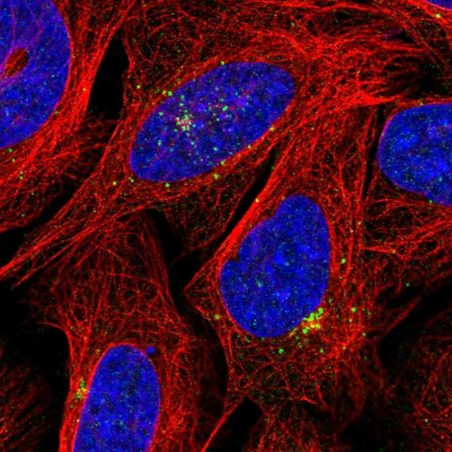 PPP1R21 Antibody in Immunocytochemistry (ICC/IF)