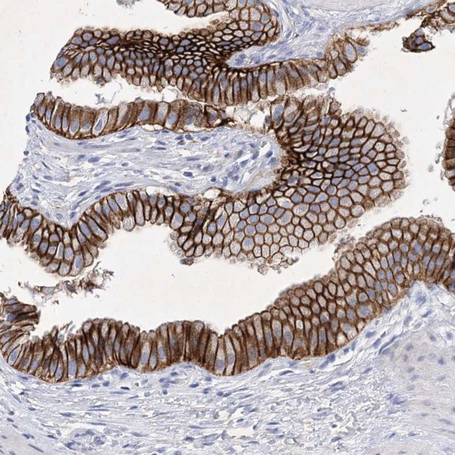 GPN1 Antibody in Immunohistochemistry (Paraffin) (IHC (P))
