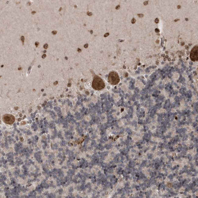 SOWAHB Antibody in Immunohistochemistry (Paraffin) (IHC (P))