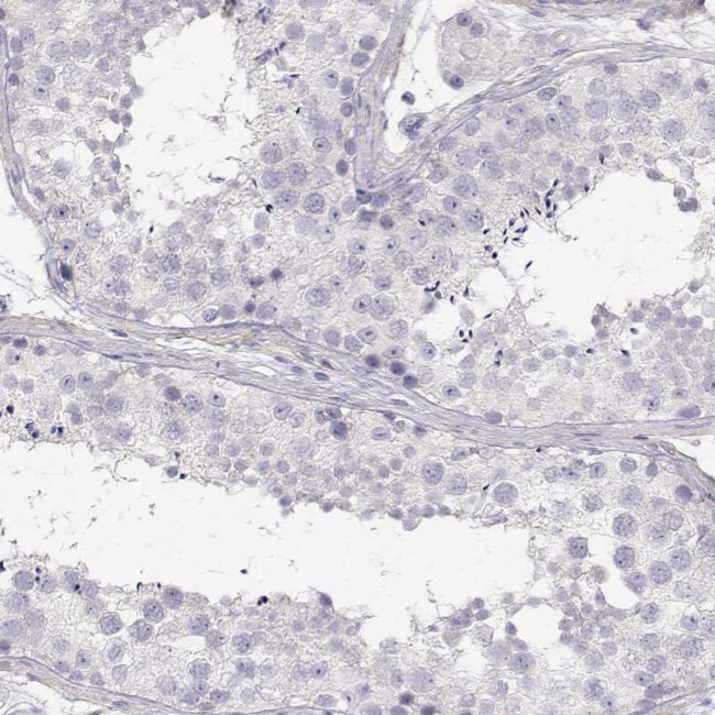 CDHR1 Antibody in Immunohistochemistry (Paraffin) (IHC (P))