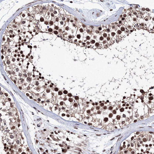 TATD2 Antibody in Immunohistochemistry (Paraffin) (IHC (P))