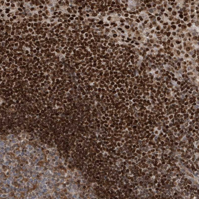 QTRTD1 Antibody in Immunohistochemistry (Paraffin) (IHC (P))