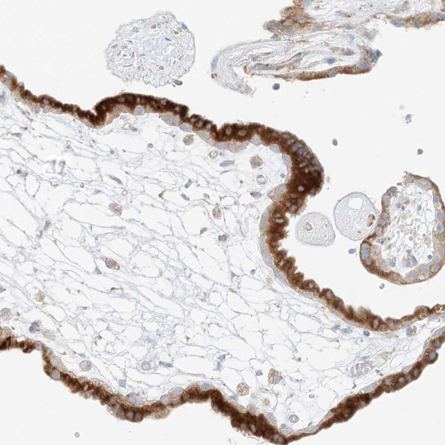 STK11IP Antibody in Immunohistochemistry (Paraffin) (IHC (P))
