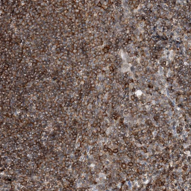 PRMT9 Antibody in Immunohistochemistry (Paraffin) (IHC (P))