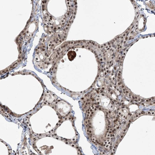 HELQ Antibody in Immunohistochemistry (Paraffin) (IHC (P))