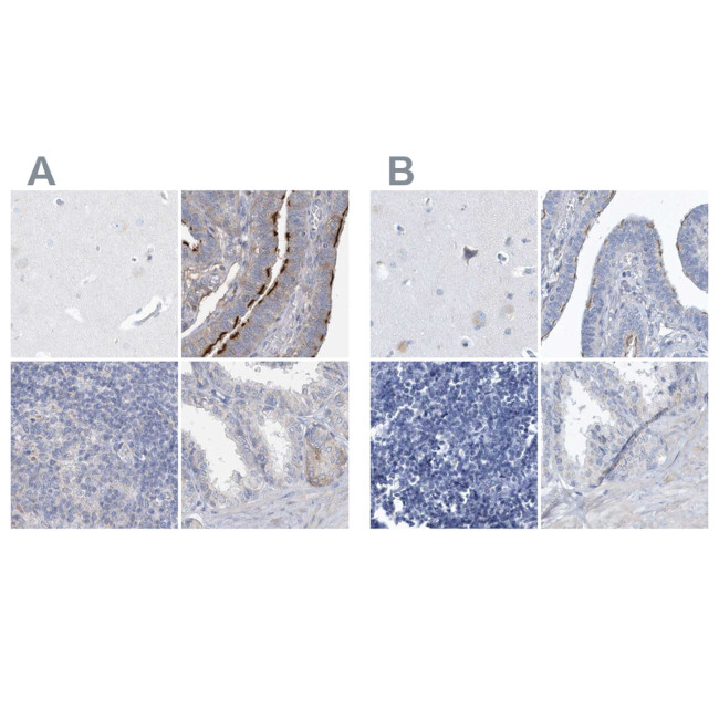SPATA18 Antibody in Immunohistochemistry (IHC)