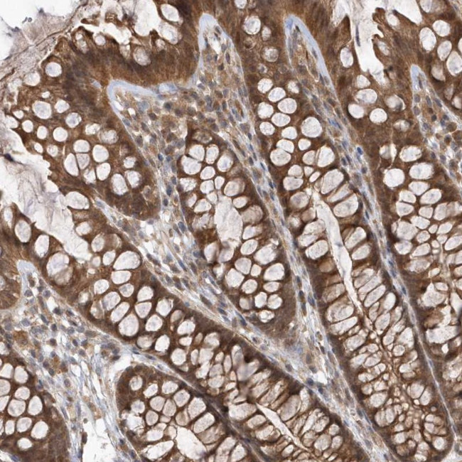GFM2 Antibody in Immunohistochemistry (Paraffin) (IHC (P))