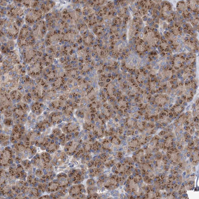 COPB2 Antibody in Immunohistochemistry (Paraffin) (IHC (P))