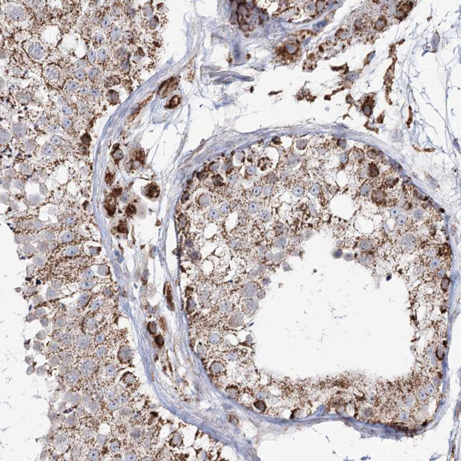 CWF19L1 Antibody in Immunohistochemistry (Paraffin) (IHC (P))