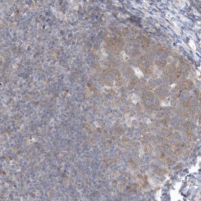 ZC3H12D Antibody in Immunohistochemistry (Paraffin) (IHC (P))