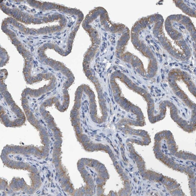 PPM1E Antibody in Immunohistochemistry (IHC)