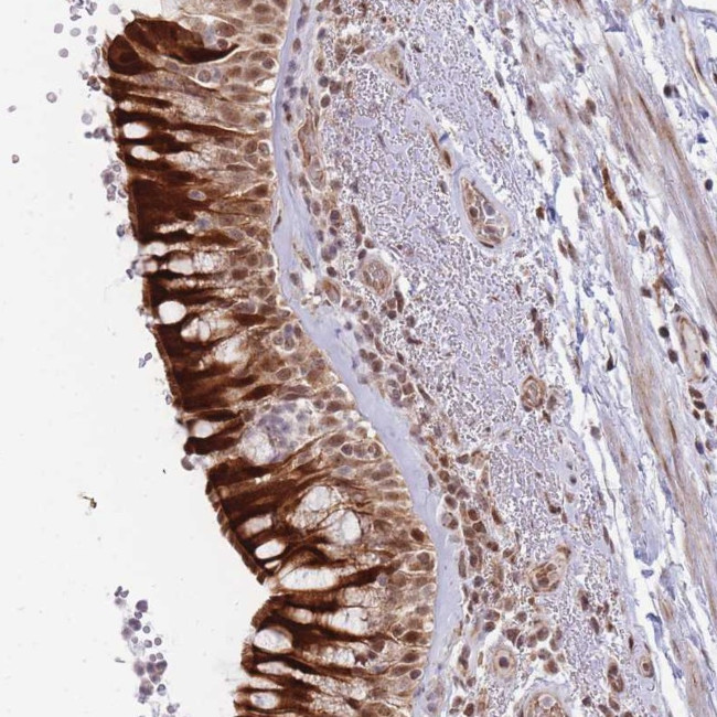 FAM44A Antibody in Immunohistochemistry (Paraffin) (IHC (P))