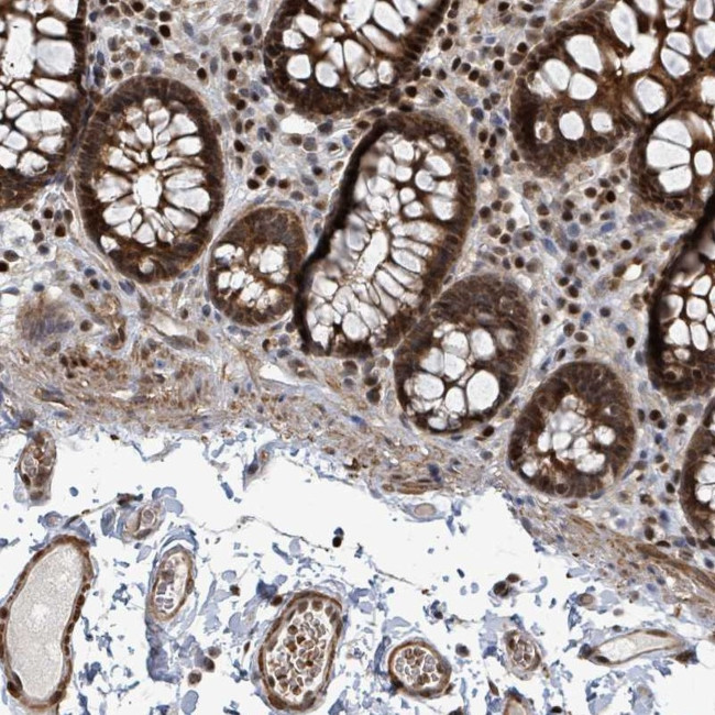 DNMT2 Antibody in Immunohistochemistry (Paraffin) (IHC (P))
