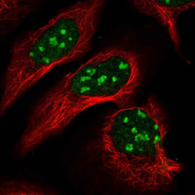 DNMT2 Antibody in Immunocytochemistry (ICC/IF)
