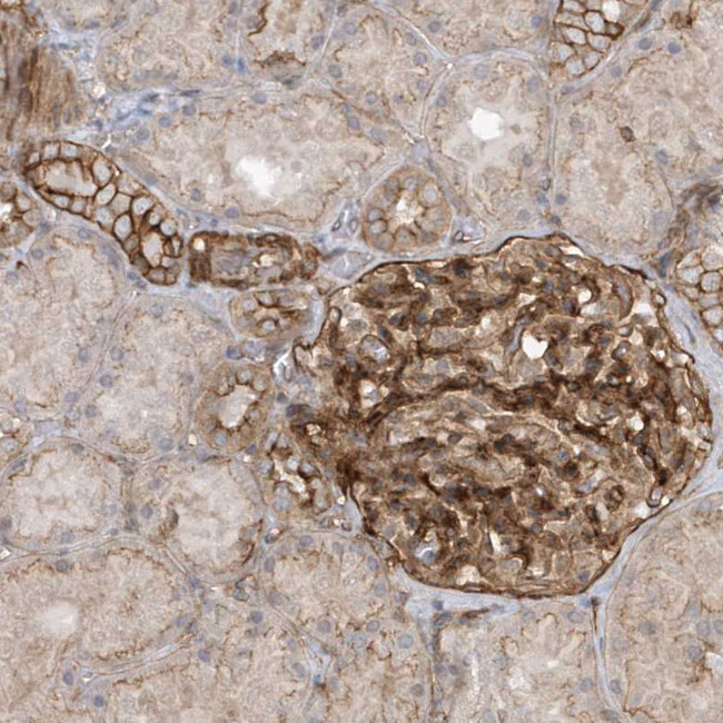 RAI14 Antibody in Immunohistochemistry (Paraffin) (IHC (P))