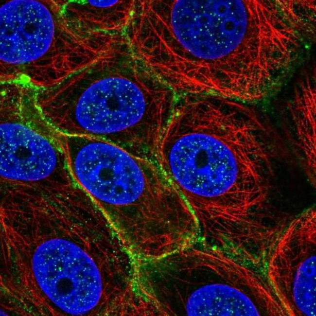 SLC5A6 Antibody in Immunocytochemistry (ICC/IF)