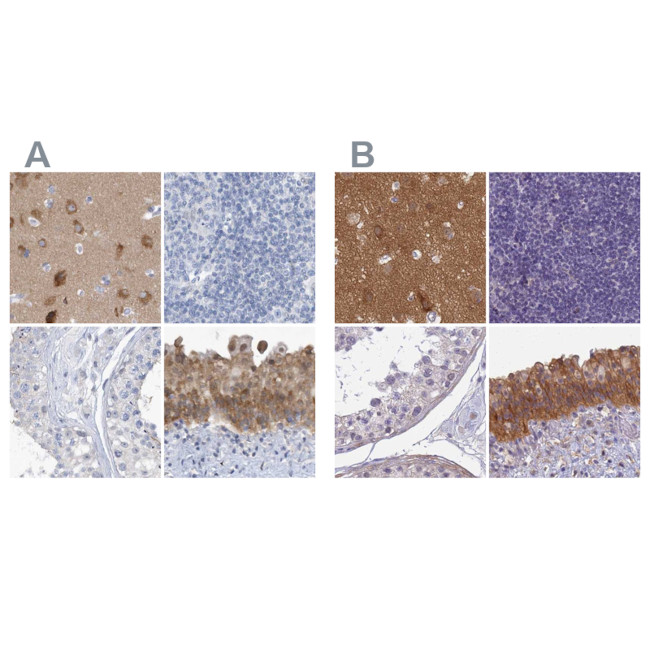 SRGAP3 Antibody in Immunohistochemistry (IHC)