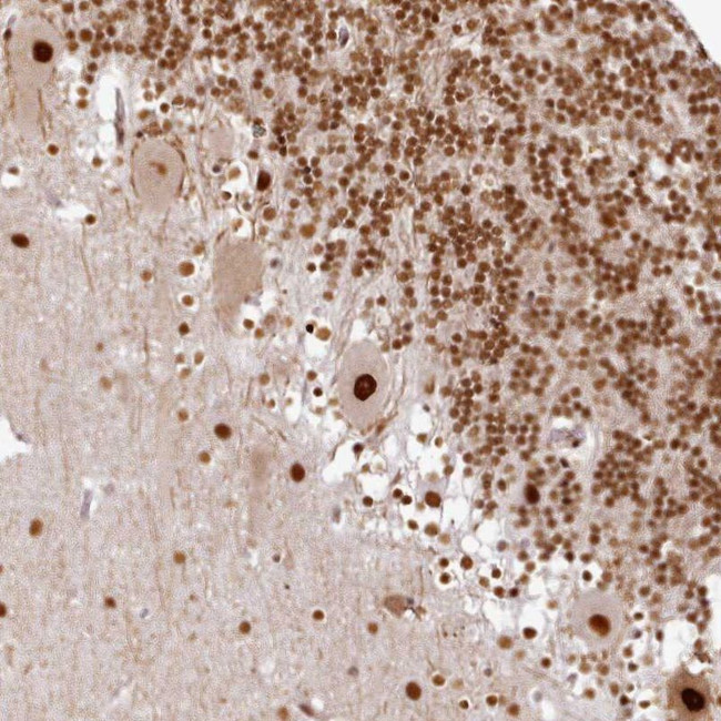 SYT15 Antibody in Immunohistochemistry (IHC)