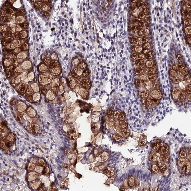 SYT15 Antibody in Immunohistochemistry (Paraffin) (IHC (P))
