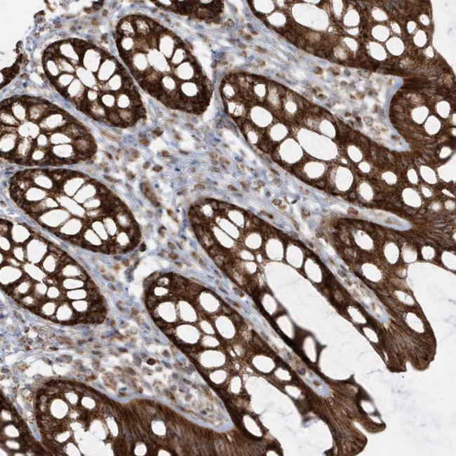 CLUAP1 Antibody in Immunohistochemistry (Paraffin) (IHC (P))