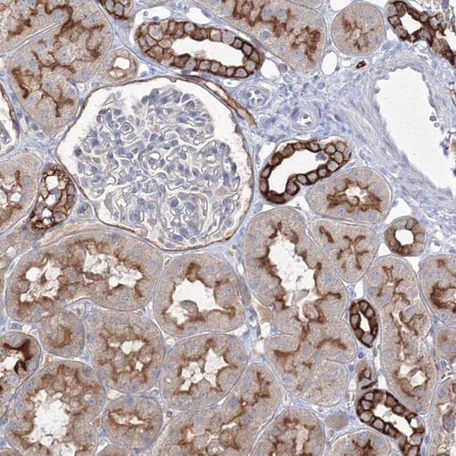 TMEM139 Antibody in Immunohistochemistry (IHC)
