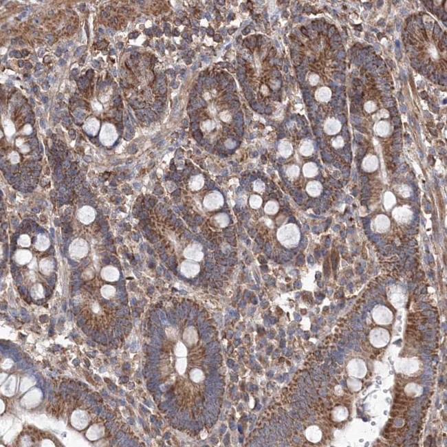 TMEM139 Antibody in Immunohistochemistry (Paraffin) (IHC (P))