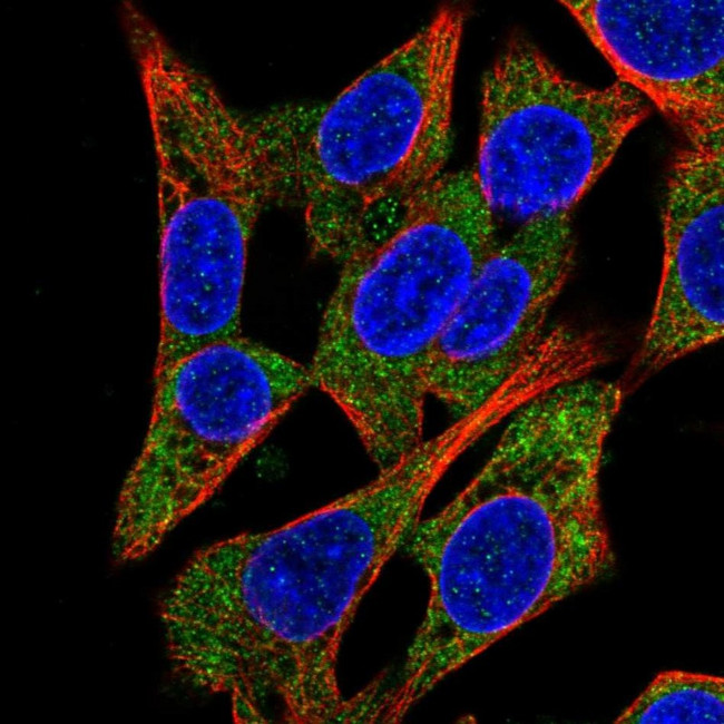 QARS Antibody in Immunocytochemistry (ICC/IF)