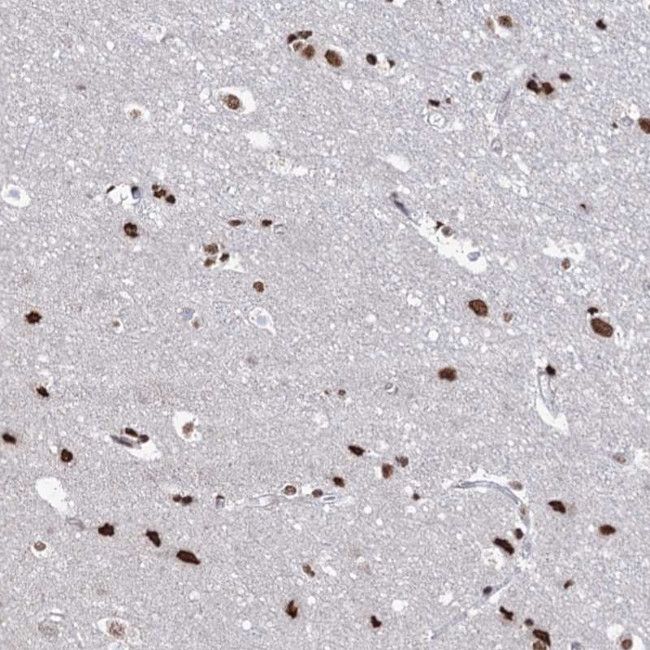 ABHD10 Antibody in Immunohistochemistry (Paraffin) (IHC (P))