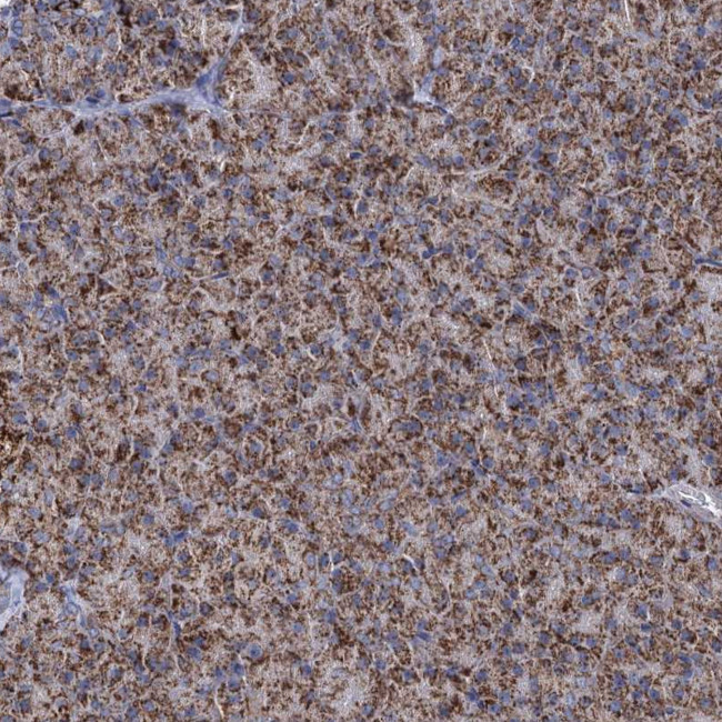 ABHD10 Antibody in Immunohistochemistry (Paraffin) (IHC (P))