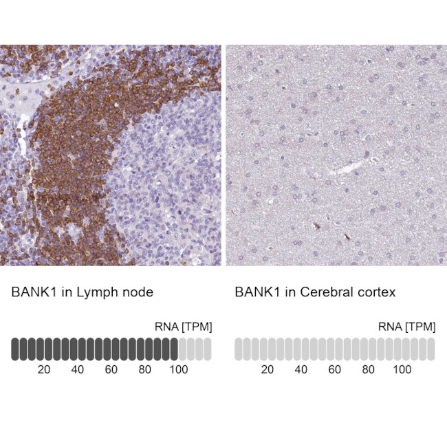 BANK1 Antibody in Immunohistochemistry (IHC)