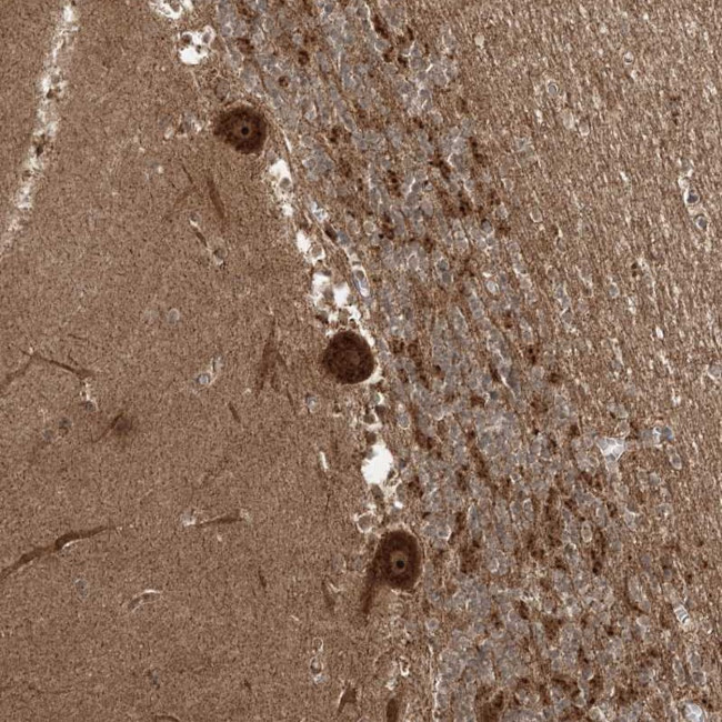 C10orf113 Antibody in Immunohistochemistry (Paraffin) (IHC (P))
