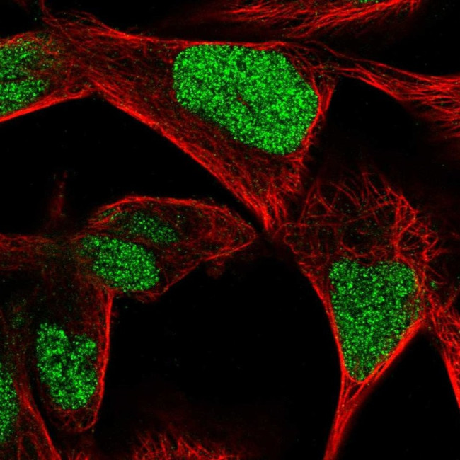 CGGBP1 Antibody in Immunocytochemistry (ICC/IF)