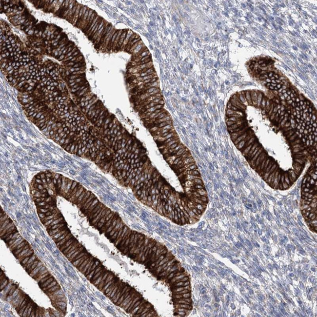 YTHDC2 Antibody in Immunohistochemistry (Paraffin) (IHC (P))