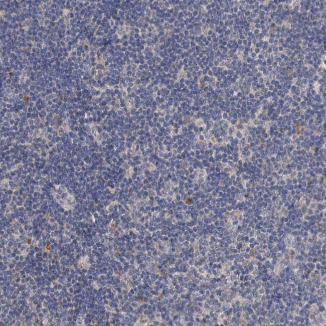 ARL13A Antibody in Immunohistochemistry (Paraffin) (IHC (P))