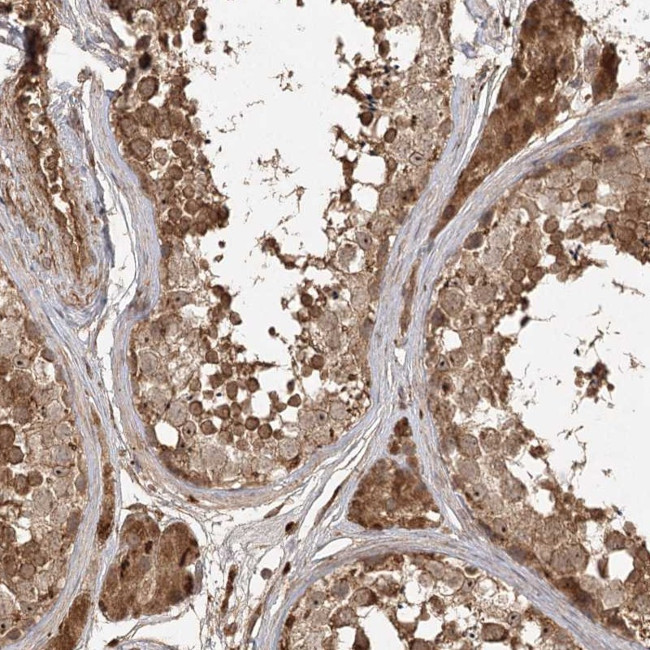ARL13A Antibody in Immunohistochemistry (IHC)