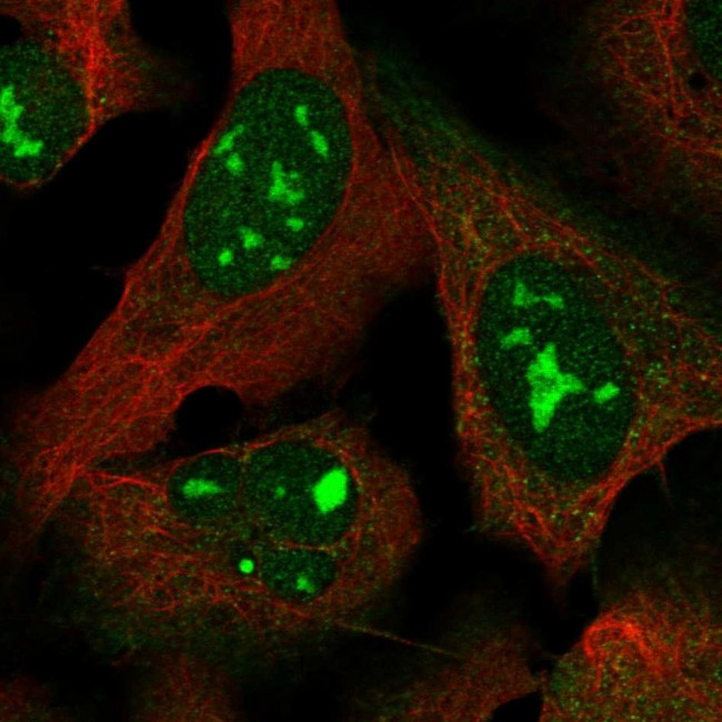 MYL5 Antibody in Immunocytochemistry (ICC/IF)