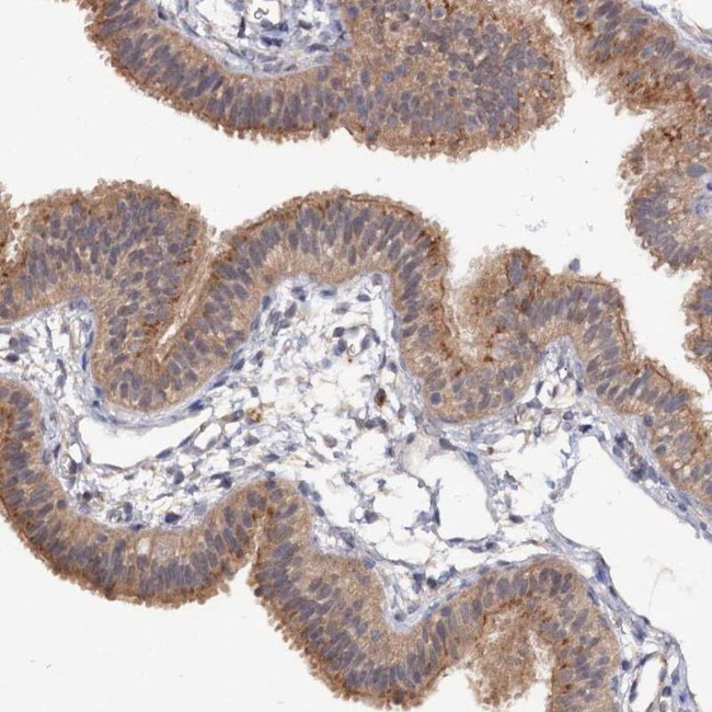 NUDCD2 Antibody in Immunohistochemistry (IHC)