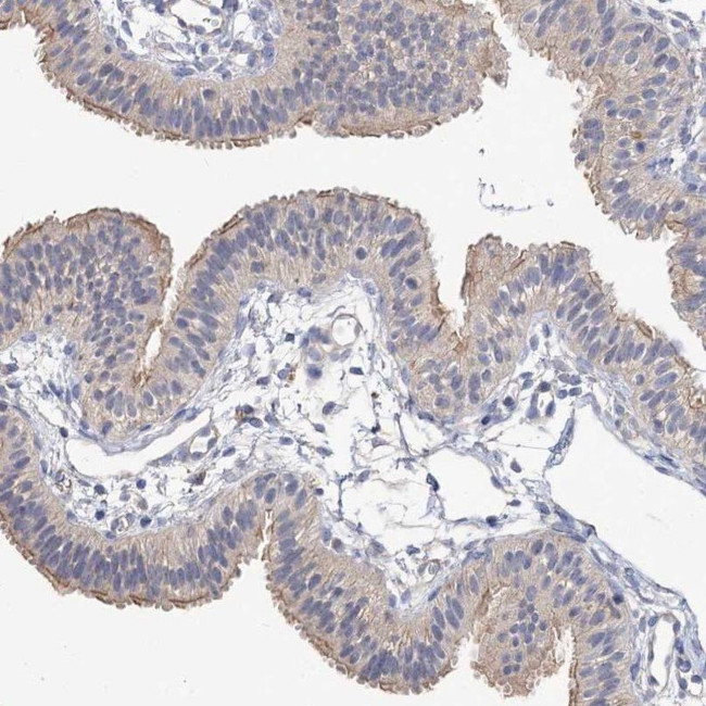 NUDCD2 Antibody in Immunohistochemistry (IHC)