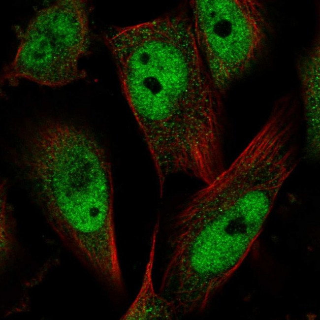 MCC Antibody in Immunocytochemistry (ICC/IF)