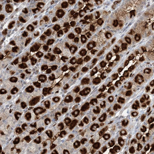 GIN1 Antibody in Immunohistochemistry (Paraffin) (IHC (P))