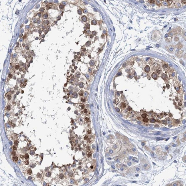 SHE Antibody in Immunohistochemistry (IHC)